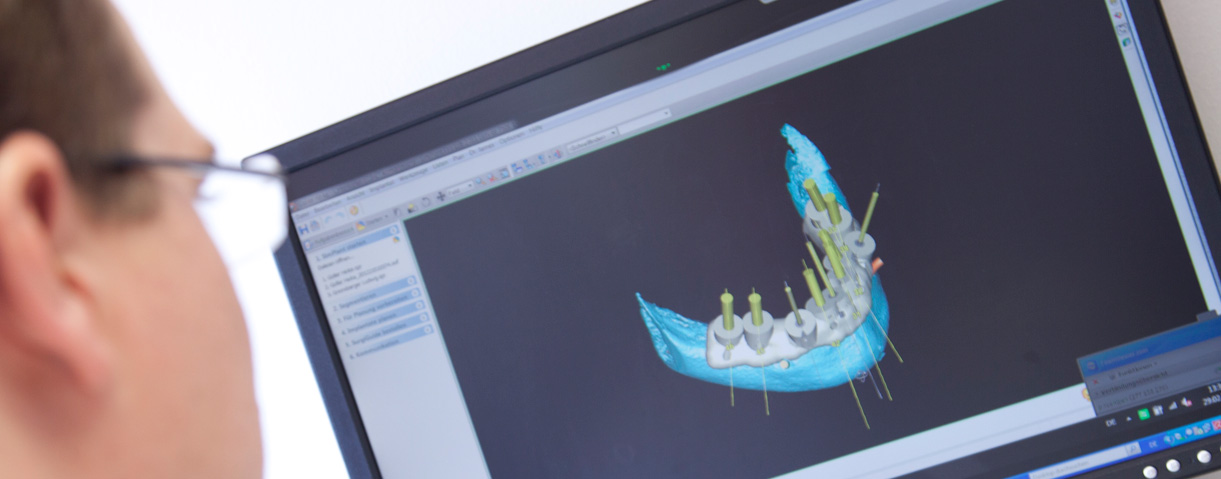 Implantologie 3D-Diagnostik – Praxis Dr. Raidl im Schongau